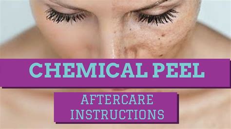 Chemical Peel Aftercare Instructions How To Care For A Chemical Peel