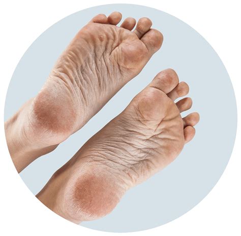 Common Foot Conditions Leicester Podiatry Centre