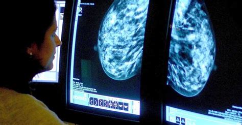 Antibody Discovery Offers Breakthrough In Breast Cancer Fight Breast Cancer Ireland