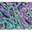 Soil Bacteria Photograph By Steve Gschmeissner/science Photo Library