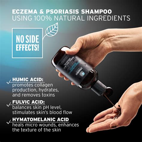 Mua Psoriasis Scalp Treatment Shampoo Peat Mud And Fulvic Acid Therapy