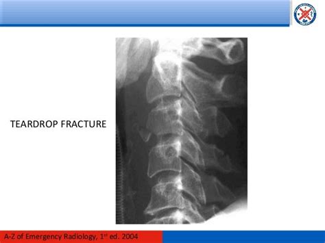 Radiology Of The Head And C Spine