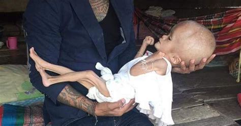 Plight Of Baby Girl Born With Oversized Head Revealed As Beautician