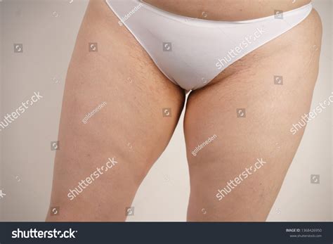 Plus Size Overweight Woman Stretches Marks Stock Photo Shutterstock