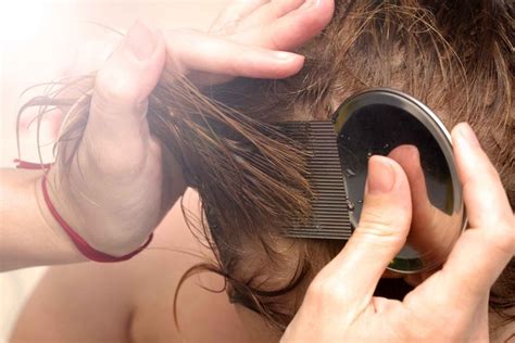 Head Lice Symptoms 7 Things To Look For The Healthy