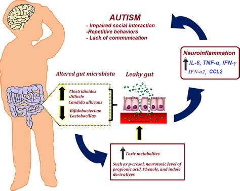 Role Of Impaired Gut Microbiota And Leaky Gut In The Etiology Of