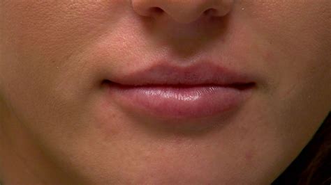 New Treatment For More Kissable Lips Wkrc