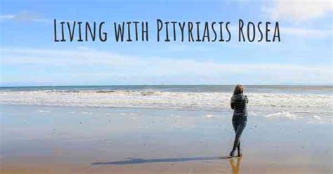 Living With Pityriasis Rosea How To Live With Pityriasis Rosea