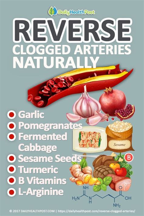 information for women you can unclog your arteries naturally natural health remedies natural
