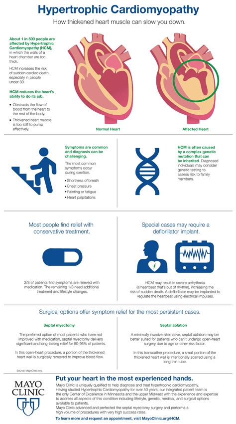 Infographic Hypertrophic Cardiomyopathy Mayo Clinic News Network