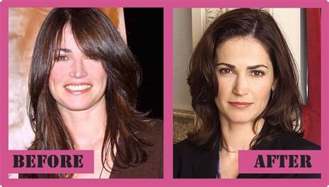 Kim Delaney Plastic Surgery How To Brawl With Signs Of Grow Old