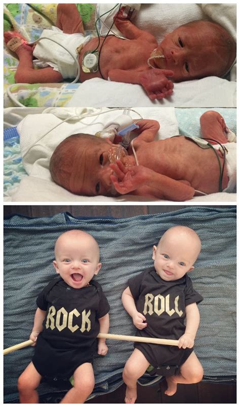 Photos Of Premature Babies Then And Now Show Their Incredible Journey