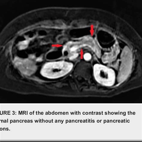 Ct Scan Of The Abdomen With Contrast Showing The Normal Pancreas