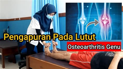 Latihan Untuk Pengapuran Lutut Oa Lutut Rematik Lutut Grade Iii