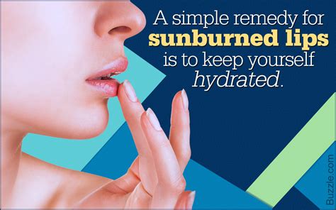Symptoms Of Sunburned Lips And Effective Ways To Treat Them