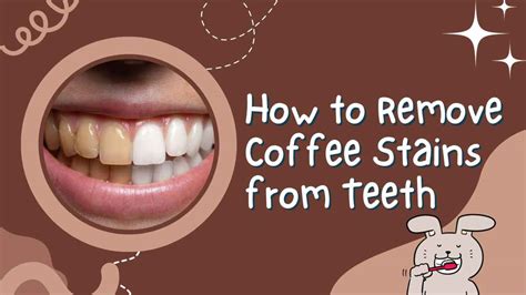 How To Remove Coffee Stains From Teeth Explained In 2023