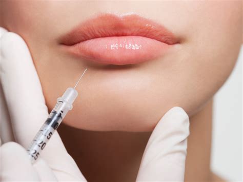 Facial Fillers And Injections Are The Biggest Trends In Plastic Surgery