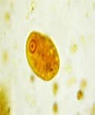 Trophozoite of Entamoeba coli, stained with iodine. | Download ...