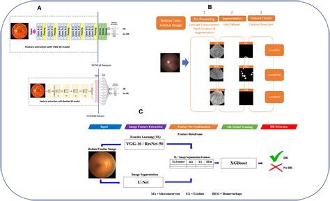 Frontiers Combining Transfer Learning With Retinal Lesion Features