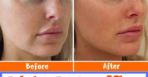 Tricks To Reaffirm Drooping Cheeks Cheek Swollen Face Facial Exercises