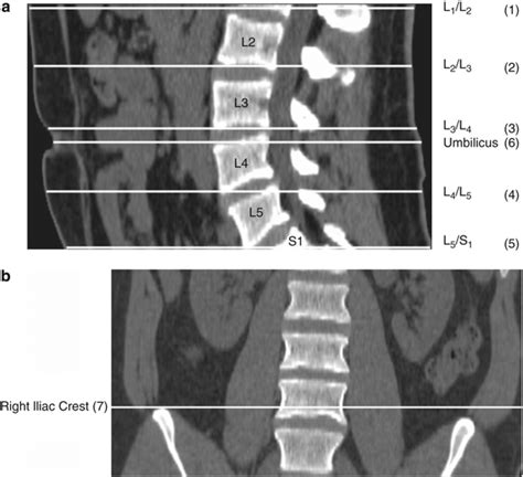 Ct Scout Image Illustrating The Defined Anatomical Landmarks At The