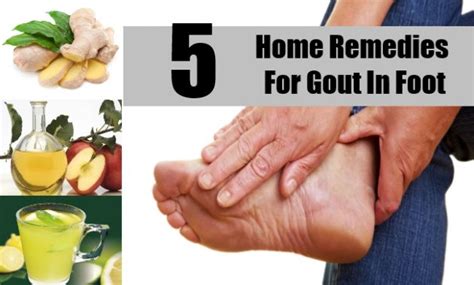 Home Treatment For Gout In Foot Get The Reliever
