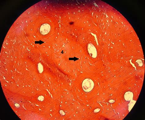 Histologia Ufjf Tecido Ósseo Osso Compacto