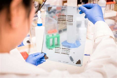 How Do You Choose The Right Western Blot Detection Method Enzo Life