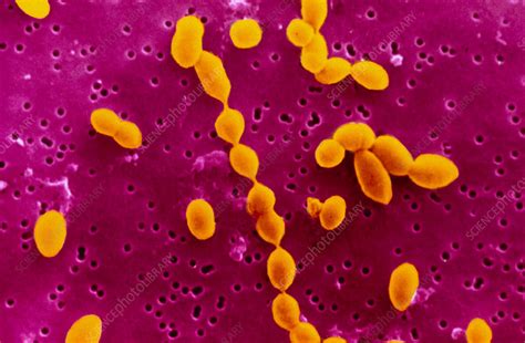 Streptococcus Pneumoniae Bacteria Stock Image B236 0103 Science