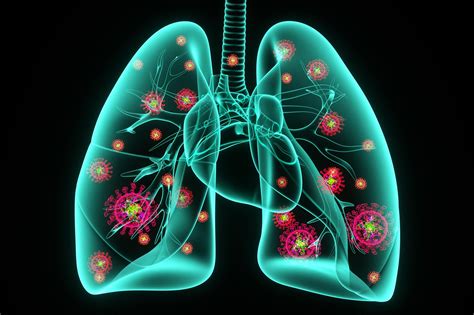 Long Covid 19 May Stem From An Overactive Immune Response In The Lungs