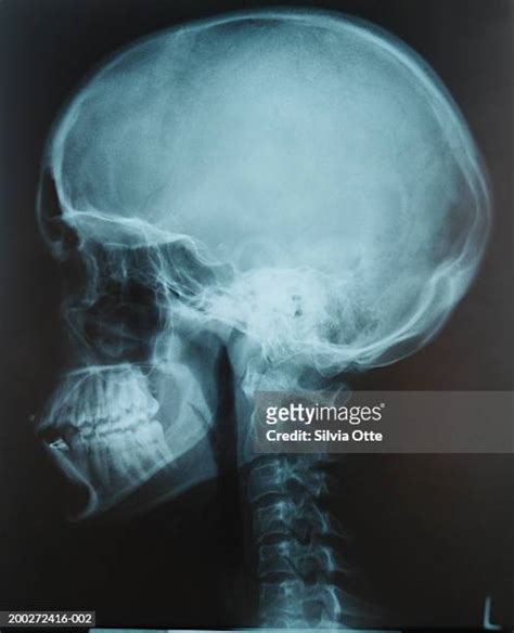 Human Skull Photos And Premium High Res Pictures Getty Images