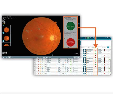 Ophthalmology Software Ophtai Evolucare Management Diagnostic