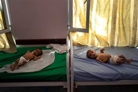 85000 Children In Yemen May Have Died Of Starvation The New York Times