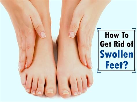 15 Effective Home Remedies For Swollen Feet My Health Only