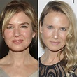 Renee Zellweger Before And After Plastic Surgery