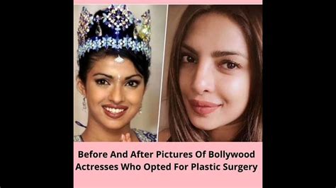 Plastic Surgery Pics Of Indian Before And After Pics Bollywood Pictures Youtube