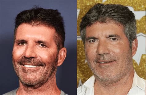 simon cowell before and after plastic surgery facelift botox sexiezpicz web porn