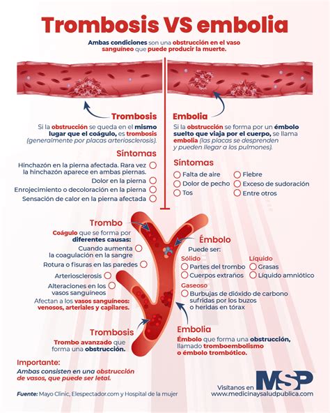 Trombosis Vs Embolia Infograf A