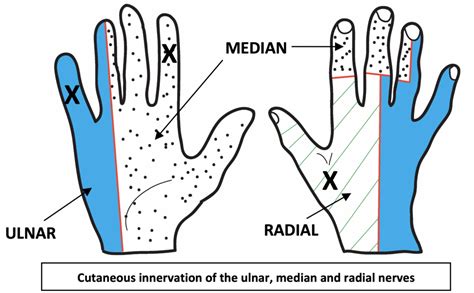 Hand And Wrist Examination Oscestop Osce Learning