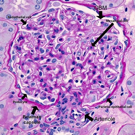 Kidney Biopsy Of The Month What Is Normal Renal Fellow Network