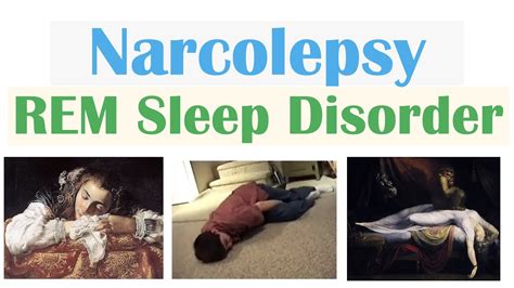Narcolepsy Sleep Disorder Causes Pathophysiology Signs Symptoms