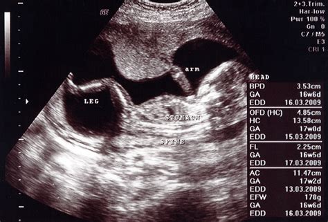 17 Weeks Pregnant Symptoms Ultrasound Belly Baby Development