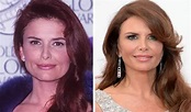Roma Downey Facelift Plastic Surgery Before and After | Celebie