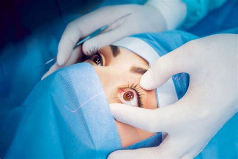 Enucleation Of The Eye Eye Removal Surgery Myvision Org