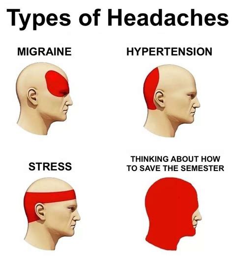 Skip S House Of Chaos Types Of Headaches