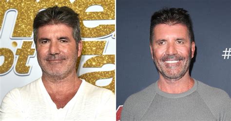 Simon Cowell Face Explained From Surgery Rumours To Vegan Diet Metro News