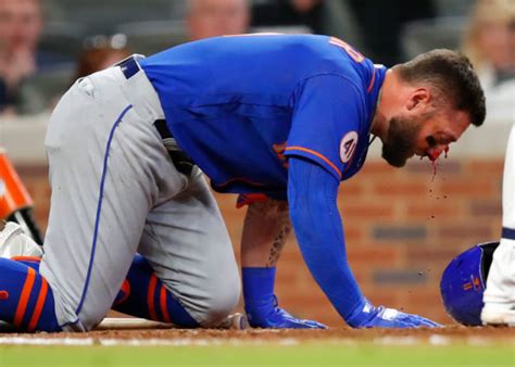 Horrific Photo Shows The Nasty Injuries Suffered By Kevin Pillar After