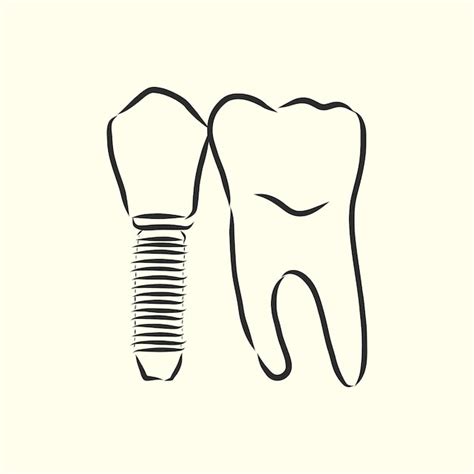 Ilustração vetorial esboços implantes dentários implante dentário