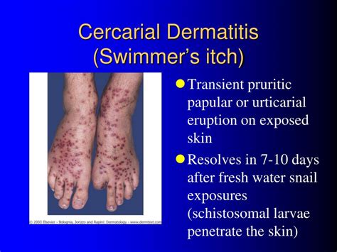 Ppt A Rash Overview Of Tropical Skin Diseases And Other Things