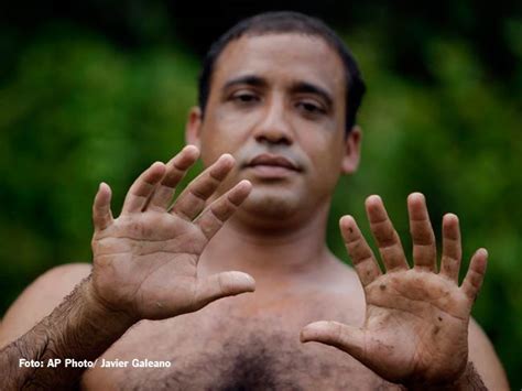 Spesies hewan seperti kucing yang ketika berjalan bertumpu jari kaki mereka disebut sebagai digitigrade. Orang Kuba Ini Miliki 12 Jari Tangan Dan Kaki